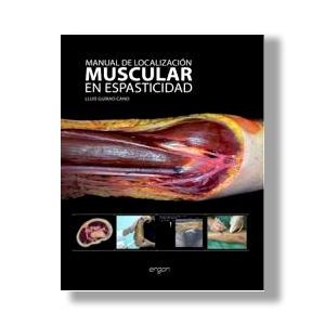 Portada libro: Manual de localización muscular en espasticidad